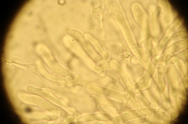 Pulcherricium caeruleum (Terana caerulea)